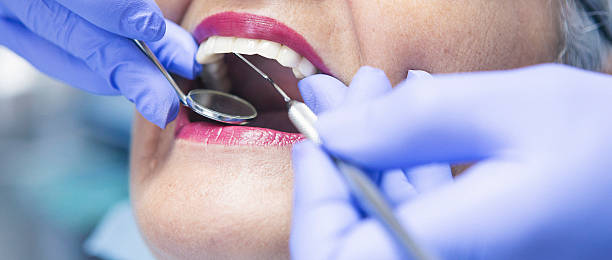Best Emergency Root Canal Treatment in Sparta, TN